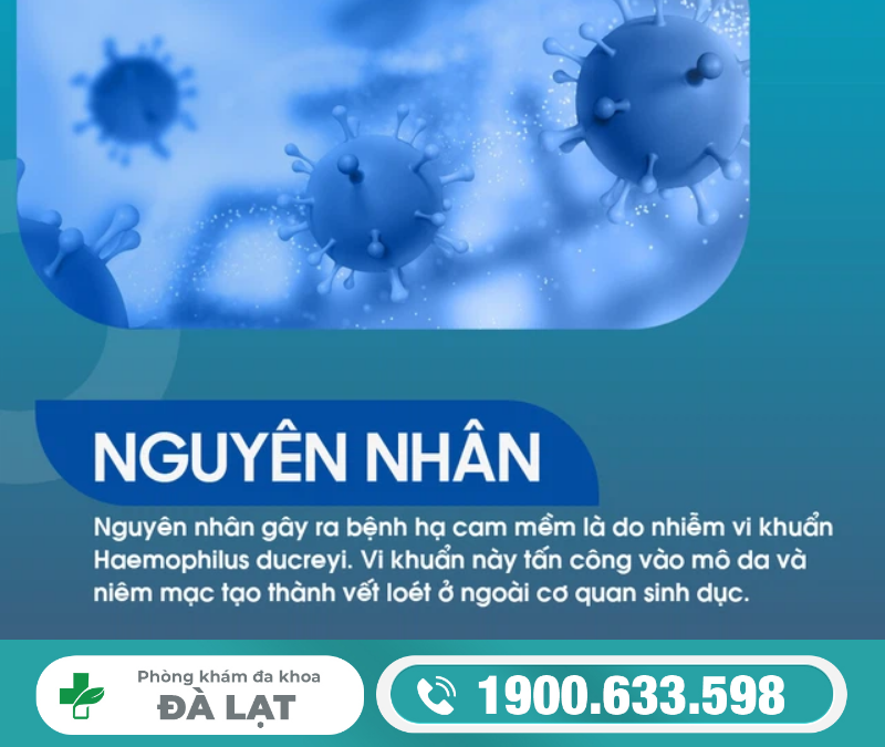 Hình ảnh minh họa